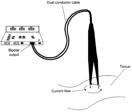 bipolar electrocautery