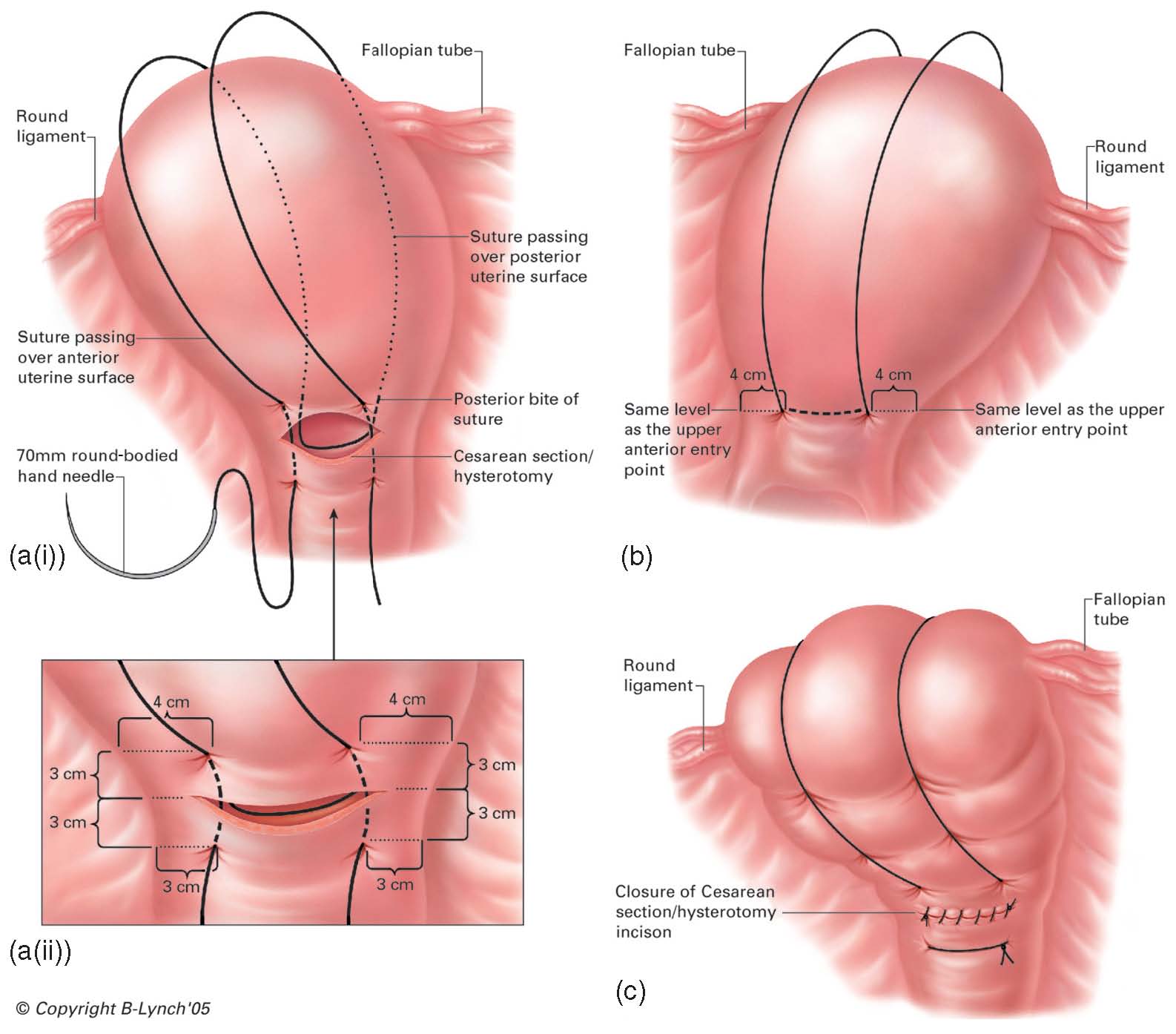 Fig.