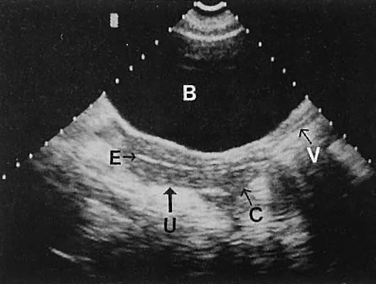 uterus menstrual phase