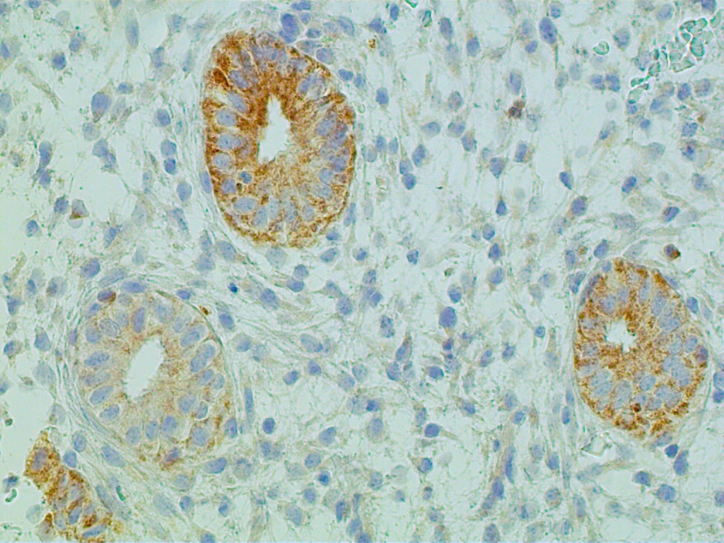 Bcl 2 Staining