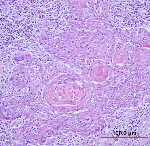 Cervical Histology