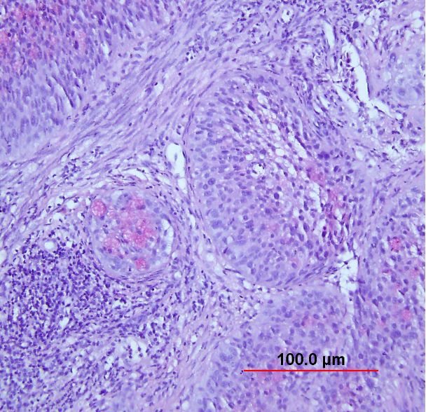 Cervical Histology