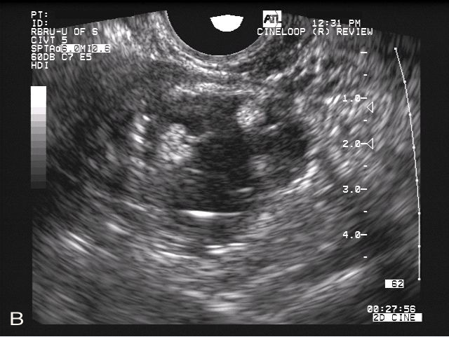 Equine Ovary