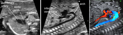 Ultrasound Atlas | GLOWM