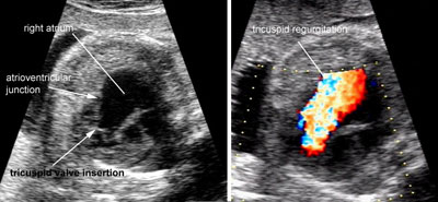 Ultrasound Atlas | GLOWM