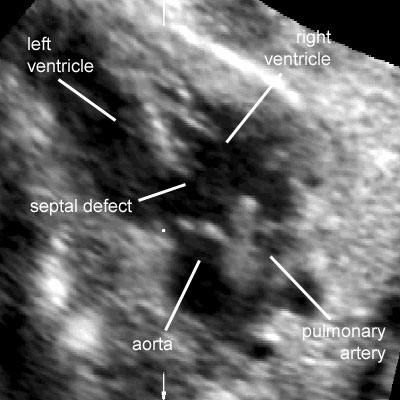 Ultrasound Atlas | GLOWM