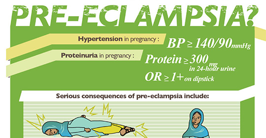 Hypertension in Pregnancy, Pre-eclampsia and Eclampsia | Wall Chart | GLOWM